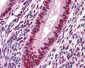 SAFB1 / SAFB Antibody (clone 5A11)